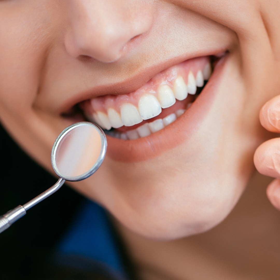 What are more dental-friendly alternatives to gum?